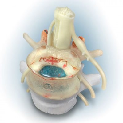 lumbar models