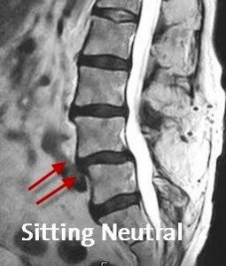 Sitting MRI