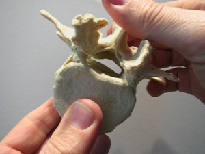 Lumbar Spinal Stenosis Model