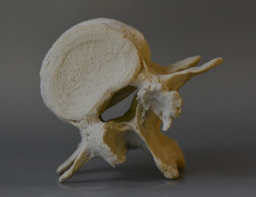 LxD Model Superior Stenosis