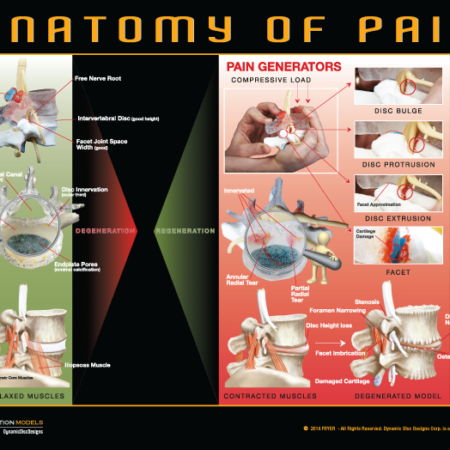 DDD Anatomy Pain Poster 2014