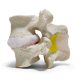 Epidural Lumbar Training Model 2