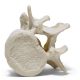 Epidural Lumbar Training Model 5