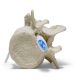Epidural Lumbar Training Model 6