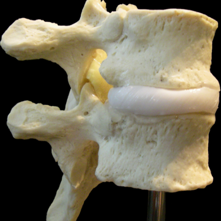 thoracic model dynamic