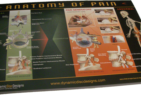 Tear off back pain mini poster