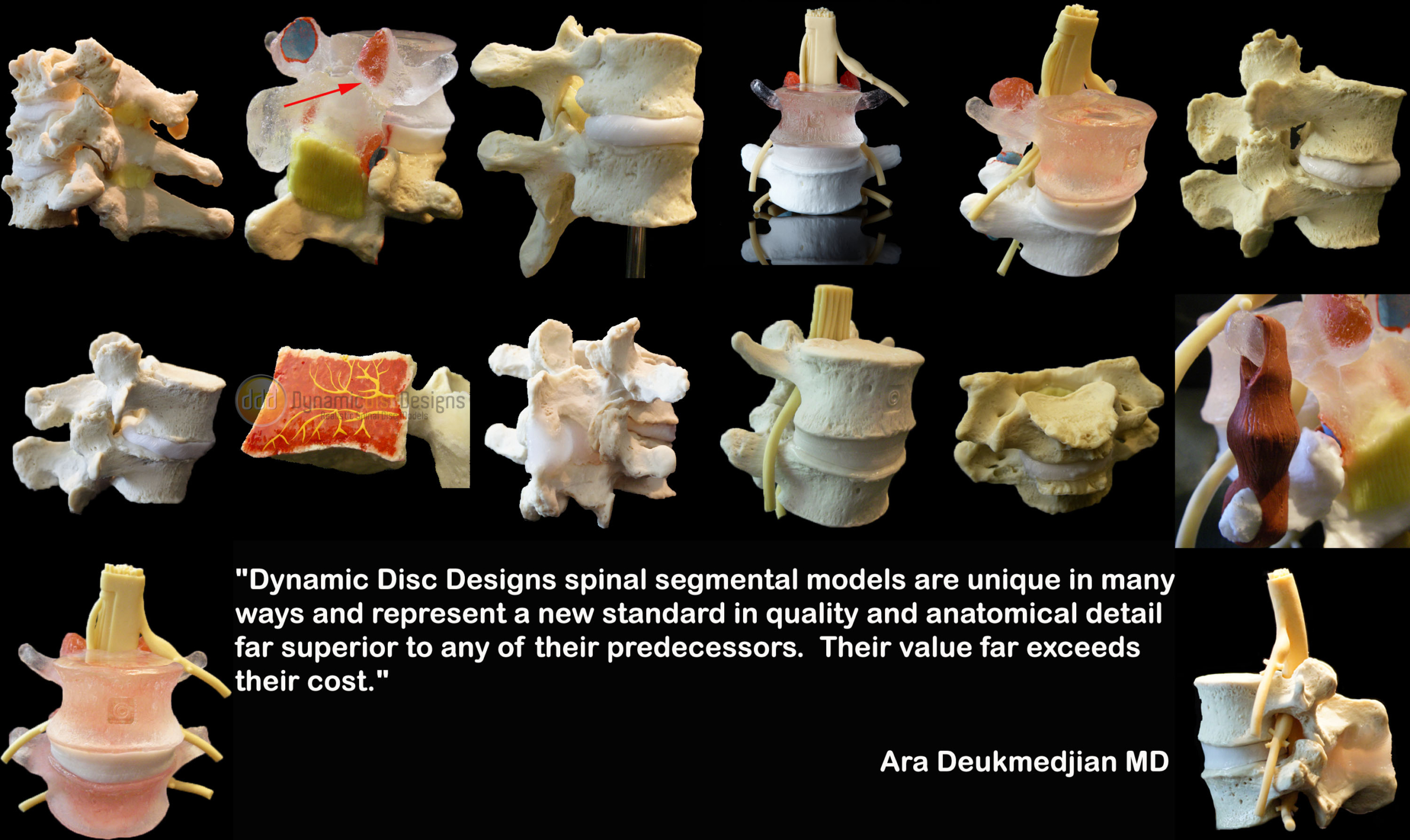 types lumbar models scaled