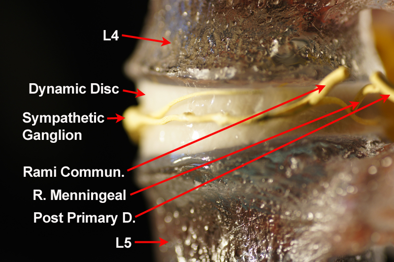 Lumbar Disc Model