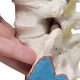 Double Spondylolisthesis Lumbar Dynamic Disc Model 6