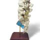 Double Spondylolisthesis Lumbar Dynamic Disc Model 7