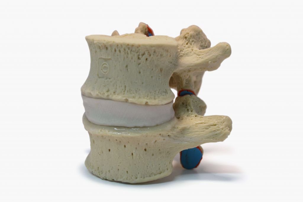 Audible Release Lumbar Model 24