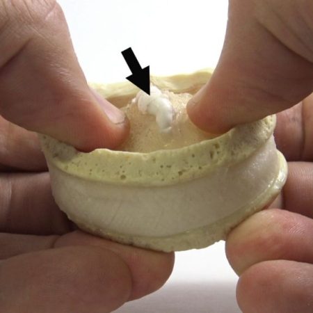 Schmorls Node Mechanism