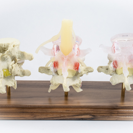 Lumbar Models