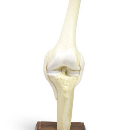 Dynamic Knee Model 2 1