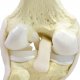 Dynamic Knee Model 7