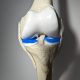 Dynamic Knee Model with Blue Menisci 4 scaled