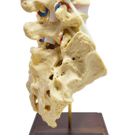 L4 Sacrum Dynamic Disc Model with cauda equina