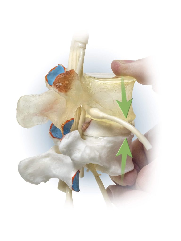 Lumbar Spine Flexion scaled 1